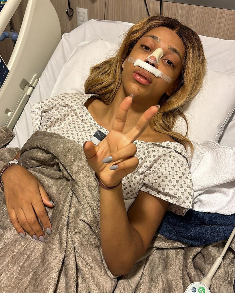 erika hilton rinoplastia
